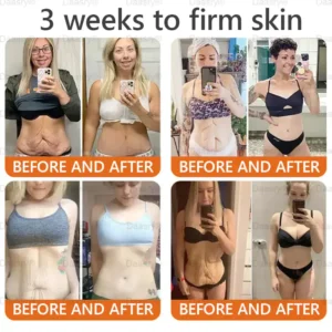 Daasry® “Dermal Gold” Botox Bee Venom Skin Restoration Cream