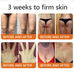 Daasry® “Dermal Gold” Botox Bee Venom Skin Restoration Cream