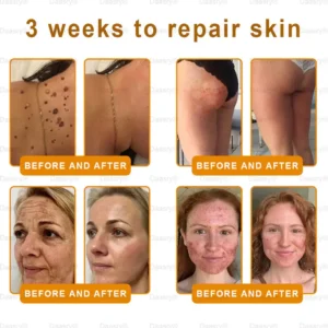 Daasry® “Dermal Gold” Botox Bee Venom Skin Restoration Cream