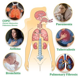 Cvreoz® Mullein Herbal Lung Purifier 13 Cvreoz® Mullein Herbal Lung Purifier