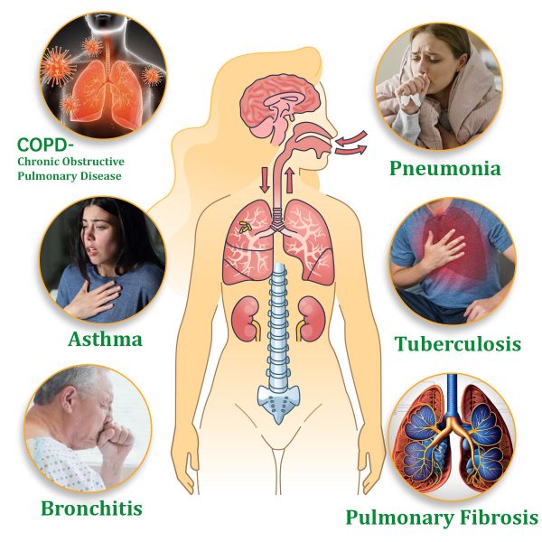 Cvreoz® Mullein Herbal Lung Purifier
