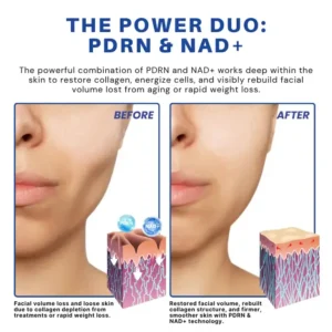 ATTDX® PDRN-NAD+ Cica Reedle Shot Serum