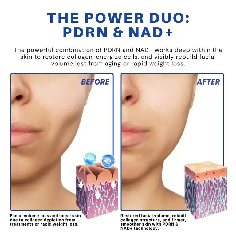 ATTDX® PDRN-NAD+ Cica Reedle Shot Serum