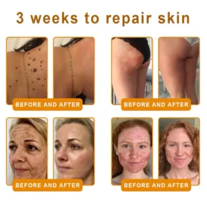 Cougex® “Dermal Gold” Botulin Bee Venom Skin Restoration Cream image Cougex® “Dermal Gold” Botulin Bee Venom Skin Restoration Cream