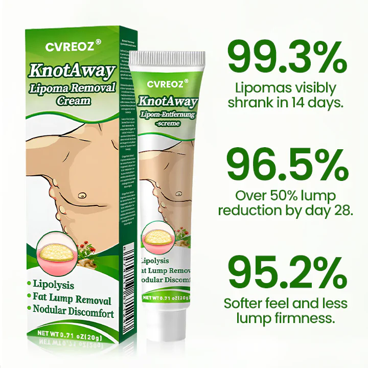 Cvreoz® KnotAway Lipoma Removal Cream