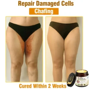 LOVILDS® Full-Body Repair Cream image LOVILDS® Full-Body Repair Cream