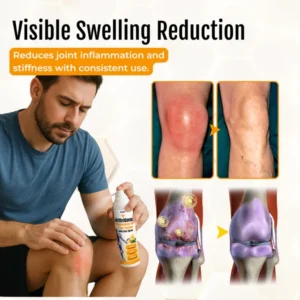 ArthriGone Magnesium Oil & Bee Venom Joint Care Spray image ArthriGone Magnesium Oil & Bee Venom Joint Care Spray