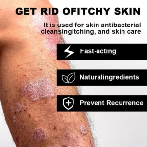 NESLEMY™ Psoriasis Cure Cream