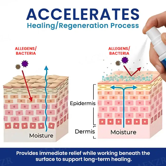 Cvreoz® Genital Treatment Spray