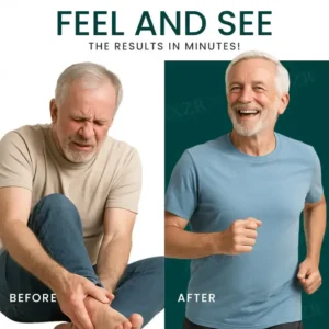 Cvreoz® GoutEase Relief Spray