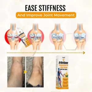 ArthriGone Magnesium Oil & Bee Venom Joint Care Spray image ArthriGone Magnesium Oil & Bee Venom Joint Care Spray