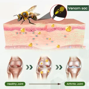 Adfire® Bee Venom Bone & Joint Revive Spray