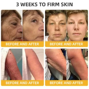 Turonu® Bee Venom Skin Remedy Cream