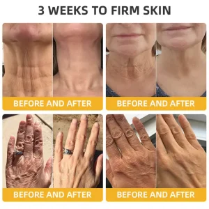 Turonu® Bee Venom Skin Remedy Cream