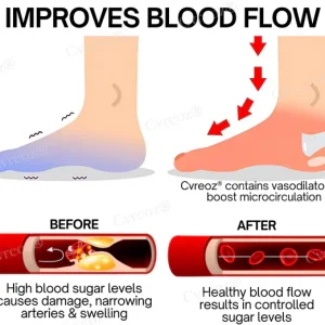 CVREOZ® BioVitaGlyco Diabetes Treatment Cream