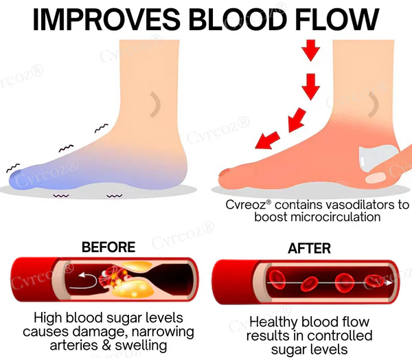 CVREOZ® BioVitaGlyco Diabetes Treatment Cream