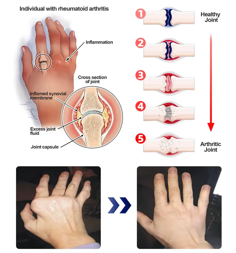 ADFIRE® Dual Action Joint Therapy Cream