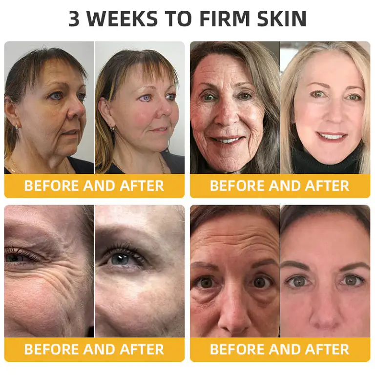 Turonu® Bee Venom Skin Remedy Cream