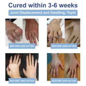 Skavix® Advanced Magnesium Pain Relief Cream image Skavix® Advanced Magnesium Pain Relief Cream