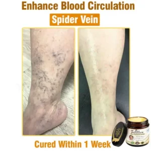 LOVILDS® Full-Body Repair Cream image LOVILDS® Full-Body Repair Cream