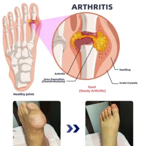 ADFIRE® Dual Action Joint Therapy Cream