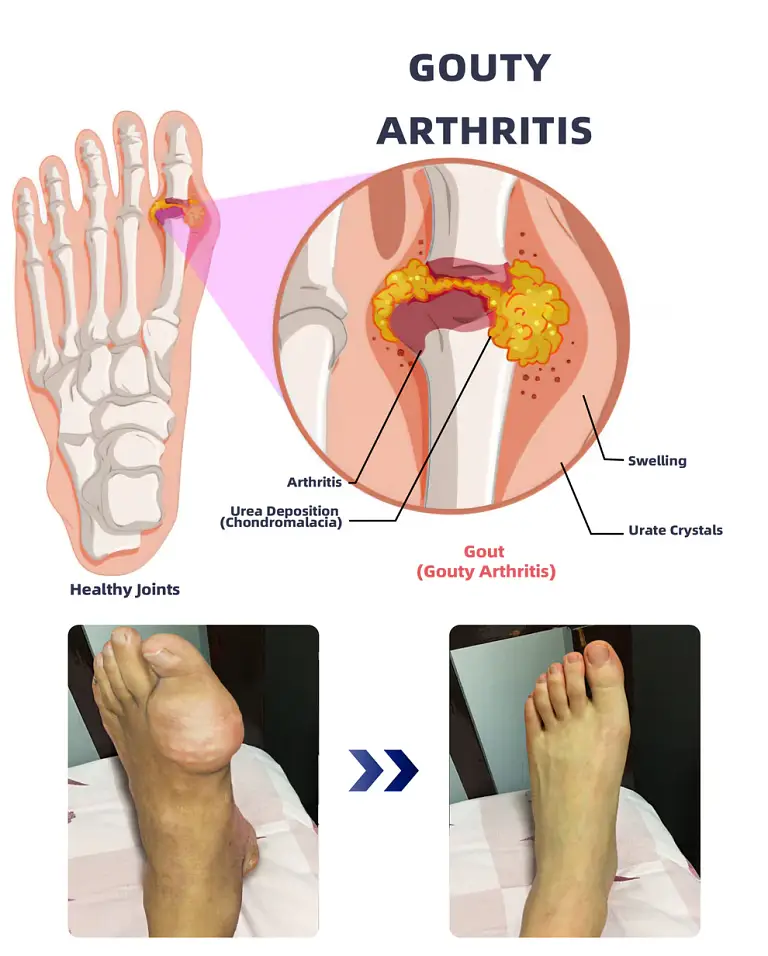 ADFIRE® Dual Action Joint Therapy Cream