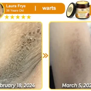 LOVILDS™ Bee Essence Skin Antibacterial Cream image LOVILDS™ Bee Essence Skin Antibacterial Cream