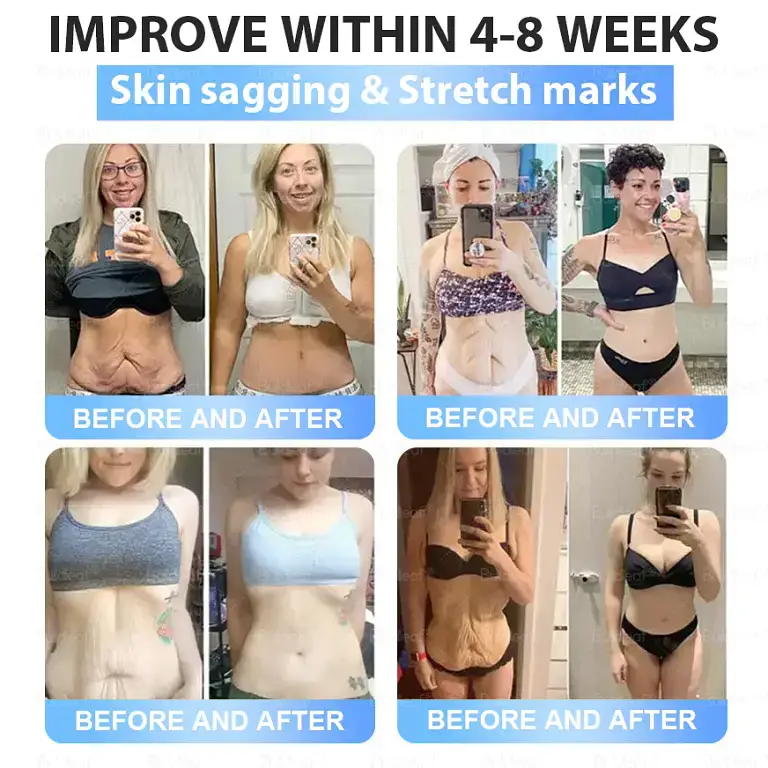 Buildleaf® Tirzepatide Slimming & Health Nano Microneedle Patch