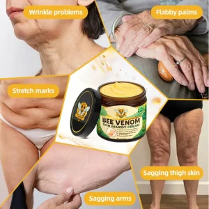 Turonu® Bee Venom Skin Remedy Cream