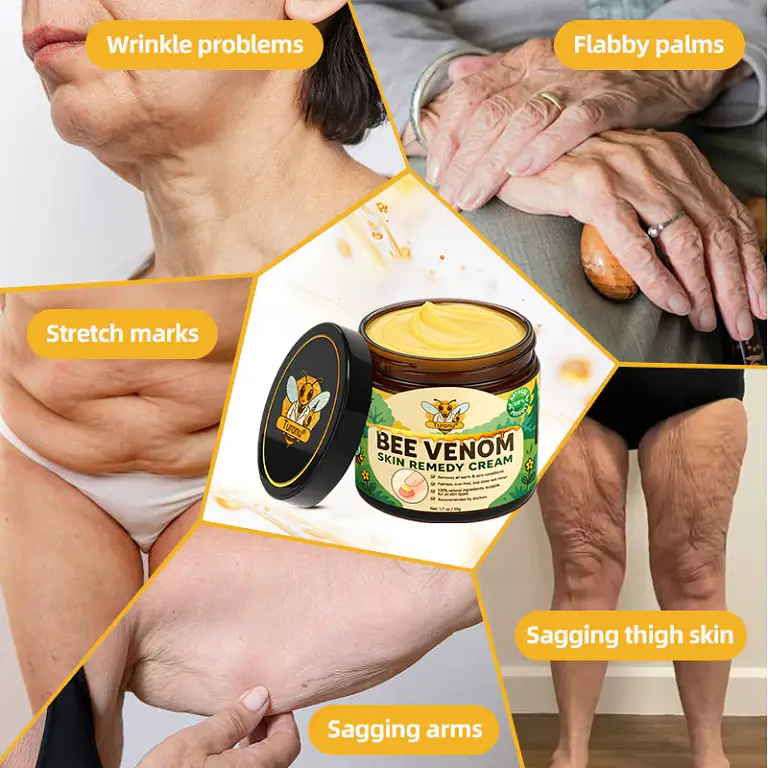 Turonu® Bee Venom Skin Remedy Cream