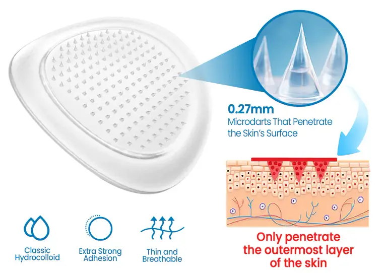 KUBOZN® Joint Pain & Inflammation Relief Microdarts Patch image KUBOZN® Joint Pain & Inflammation Relief Microdarts Patch