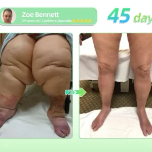 Piguíay® GLP-1 Weight Loss Oral