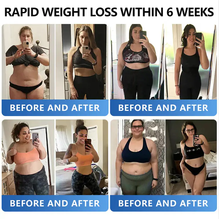 AAFQ® Nano Μicroneedle Patch with SΜGT GLP 1