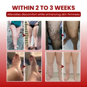 ODALIT™ SwellCare Advanced Lymphatic Drainage Massage Cream