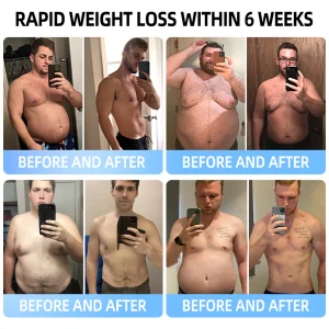 Croaie® NIDDK-Tirzepatide & Matrixyl 3000 Nano Microneedle Patch image Croaie® NIDDK-Tirzepatide & Matrixyl 3000 Nano Microneedle Patch