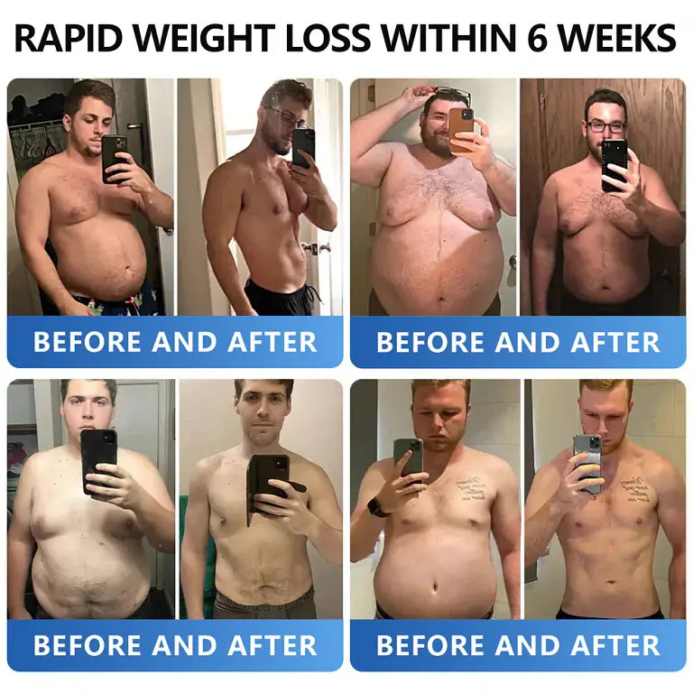 AAFQ® Nano Μicroneedle Patch with SΜGT GLP 1