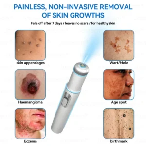 Jasseem® Non-Invasive Mole & Wart Laser Removal Pen