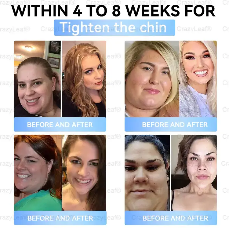 Buildleaf® Tirzepatide Slimming & Health Nano Microneedle Patch