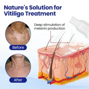 CVREOZ® Evenora Herbal Spray PRO