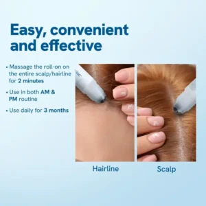 Hair Growth Roll-On Serum – See hair growth in 4 weeks