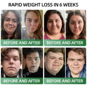 Ourlyard® Meglutide Diet Drops – Made & Shipped From Australia image Ourlyard® Meglutide Diet Drops – Made & Shipped From Australia