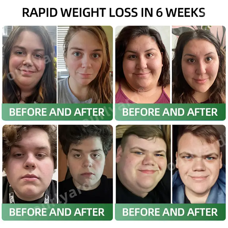 Ourlyard® Meglutide Diet Drops – Made & Shipped From Australia image Ourlyard® Meglutide Diet Drops – Made & Shipped From Australia