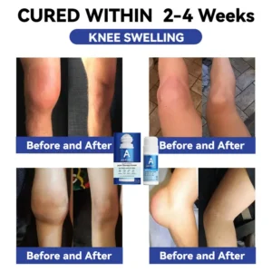 ADFIRE® Dual Action Joint Therapy Cream