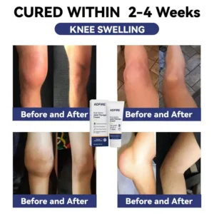 ADFIRE™ Dual Action Joint Therapy Cream