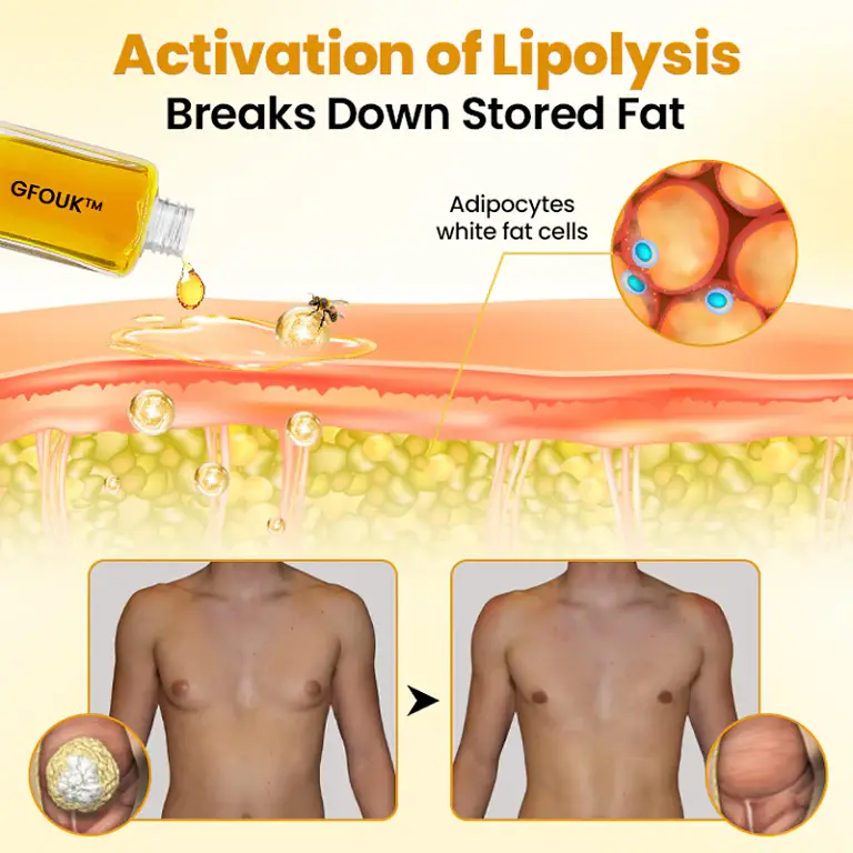 GFOUK™ ThermoFirm Bee Venom Gynecomastia-Oil image GFOUK™ ThermoFirm Bee Venom Gynecomastia-Oil