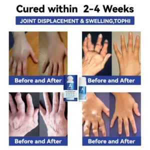 ADFIRE® Dual Action Joint Therapy Cream