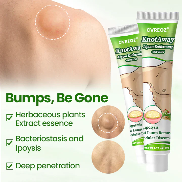 Cvreoz® KnotAway Lipoma Removal Cream
