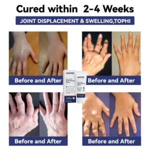 ADFIRE™ Dual Action Joint Therapy Cream