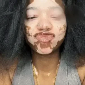 LOVILDS® Full-Body Repair Cream image LOVILDS® Full-Body Repair Cream