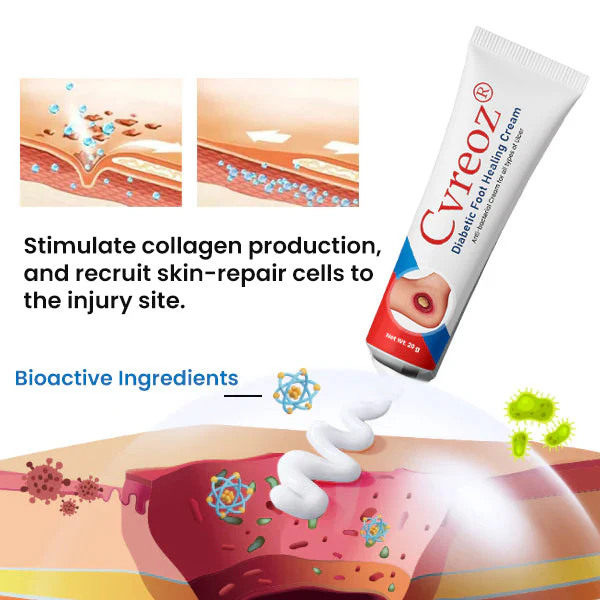 Cvreoz® Diabetic Foot Healing Cream